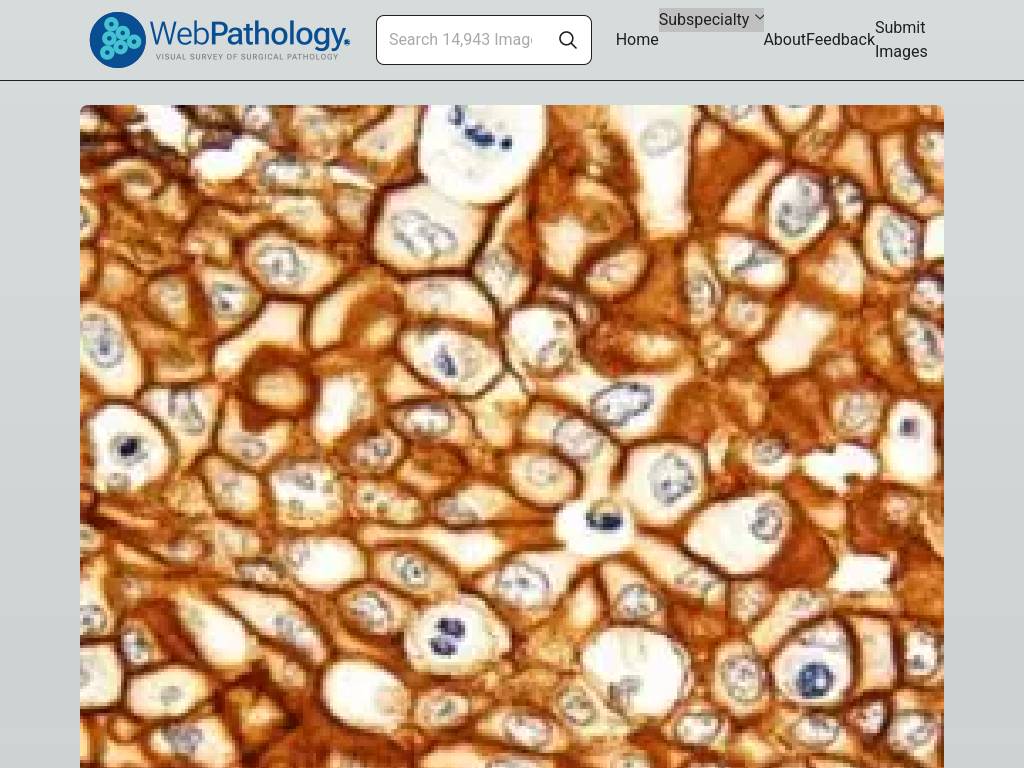 Webpathology.com